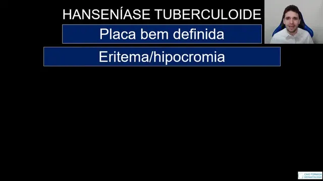 Hanseníase