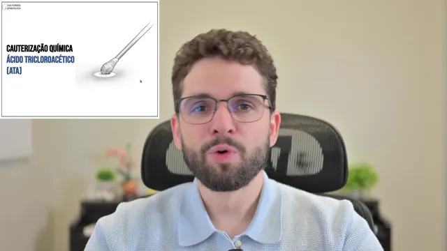 Cauterização química (ATA)