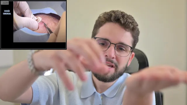 Excisão tangencial (shaving): técnica, indicações e cuidados