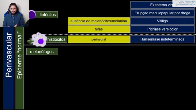 Dermatites perivasculares com epiderme "normal"