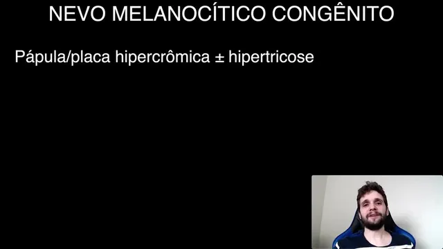 Nevo melanocítico e melanoma