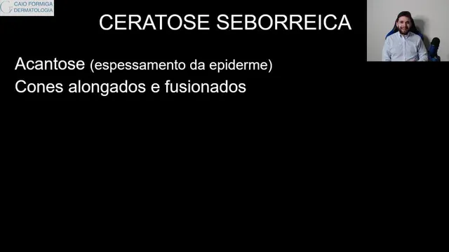 Ceratose seborreica