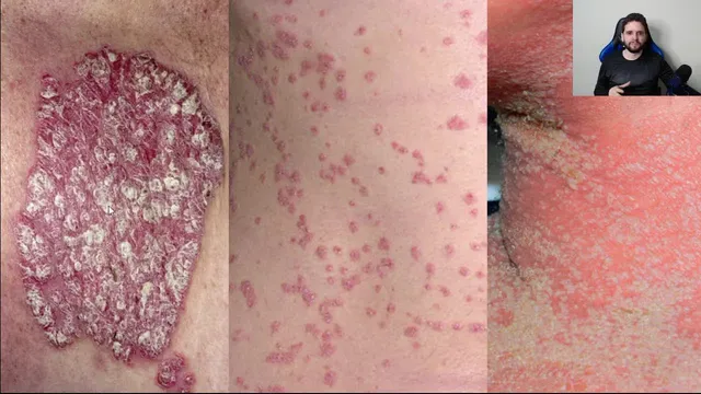 Dermatopatologia básica