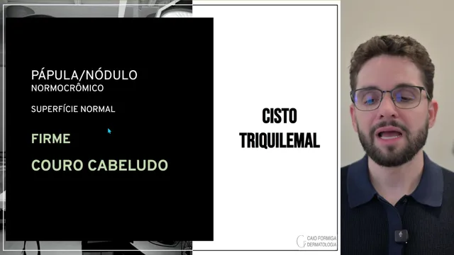 Cisto triquilemal